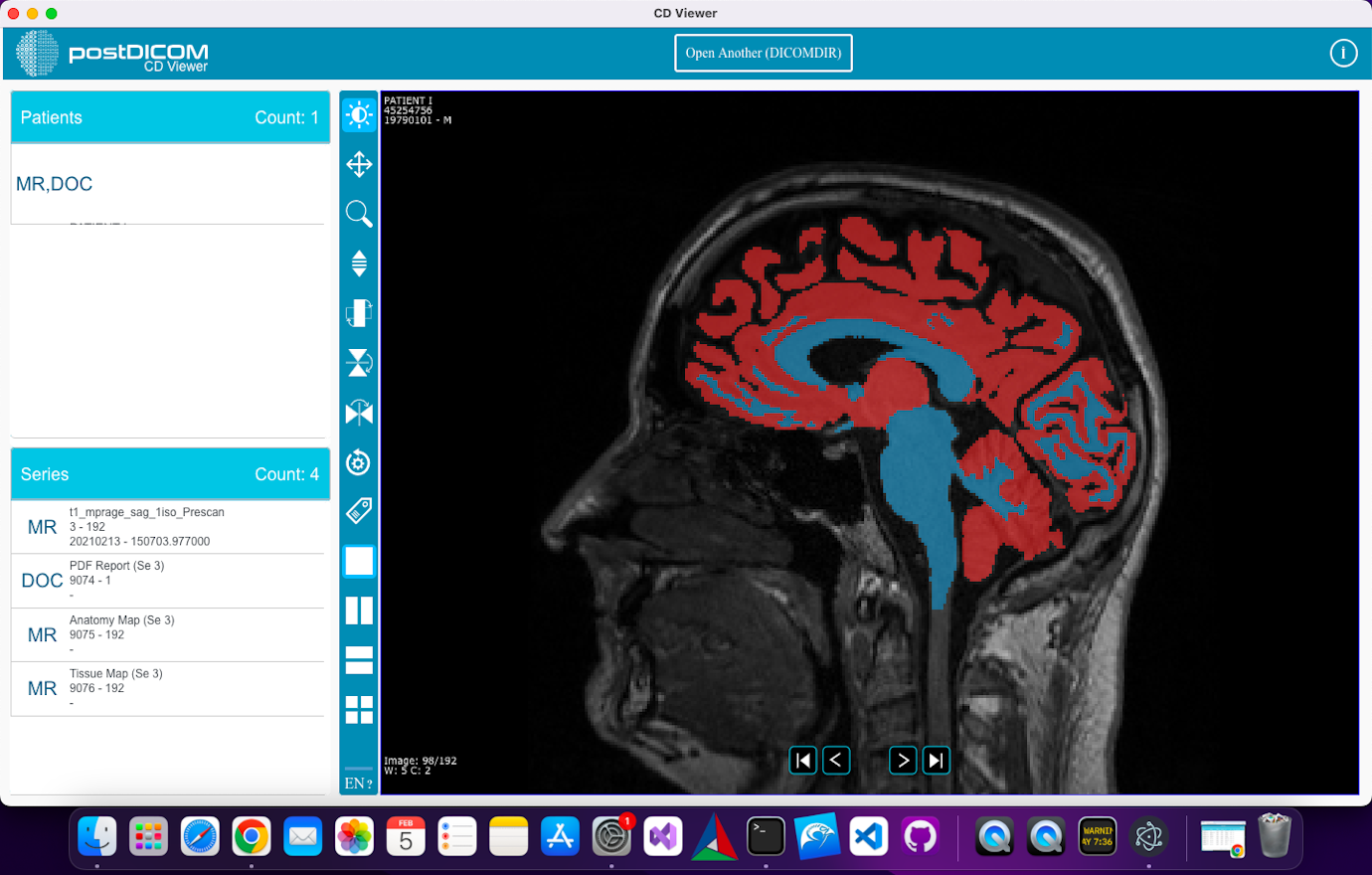 CD Viewer Usage for MacOS Monterey