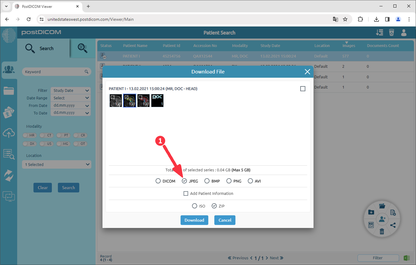 How to convert DICOM images to JPEG