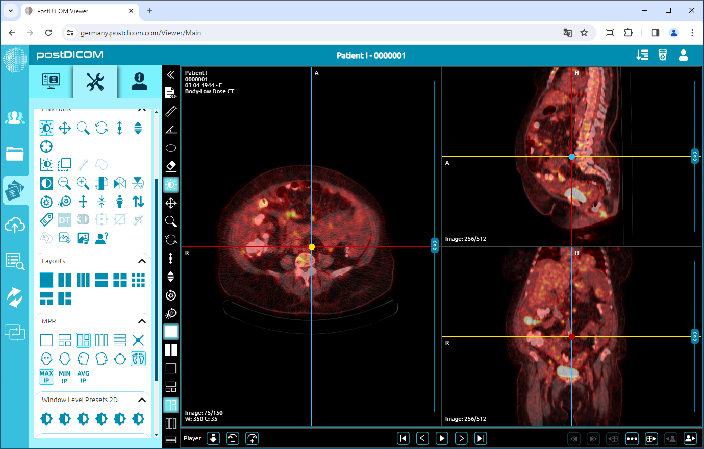 PET/CT, PET/MR Fusion