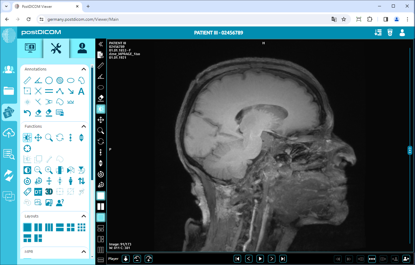 Using Negate, Rotate, Flip Vertical/Horizontal, Increase/Decrease Thickness, Zoom In/Out, Reset Functions