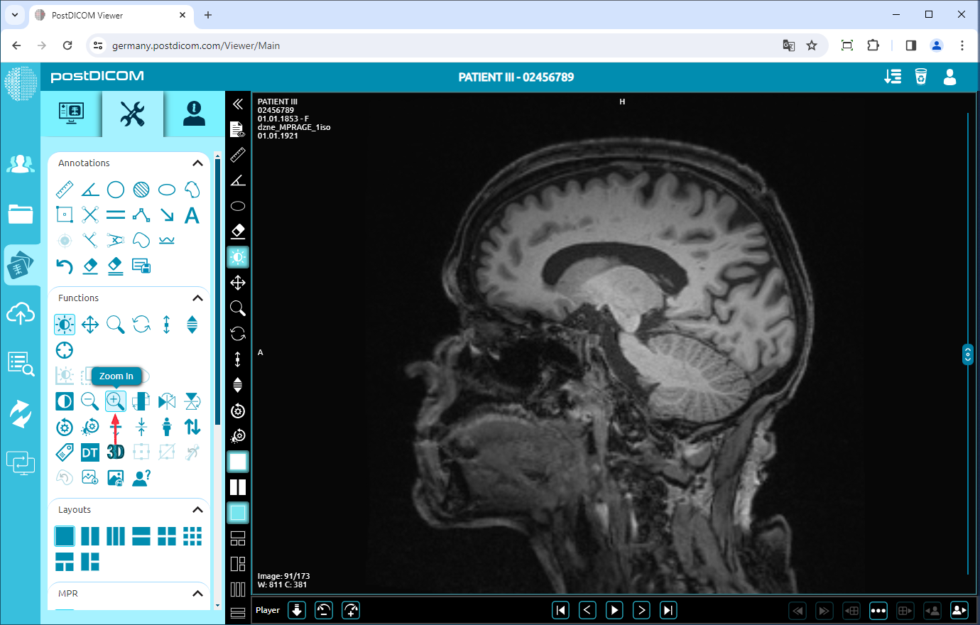 Using Negate, Rotate, Flip Vertical/Horizontal, Increase/Decrease Thickness, Zoom In/Out, Reset Functions