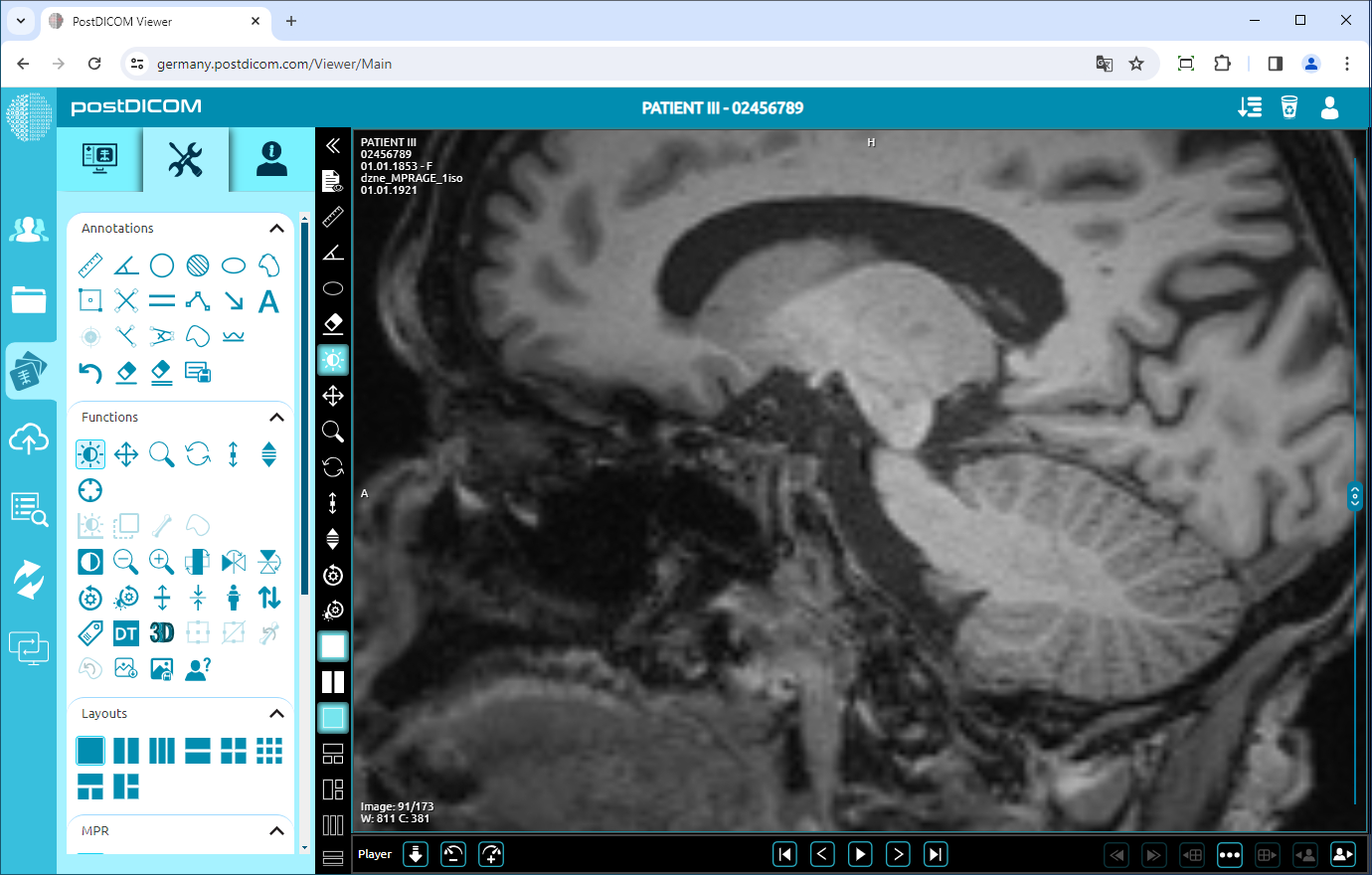 Using Negate, Rotate, Flip Vertical/Horizontal, Increase/Decrease Thickness, Zoom In/Out, Reset Functions