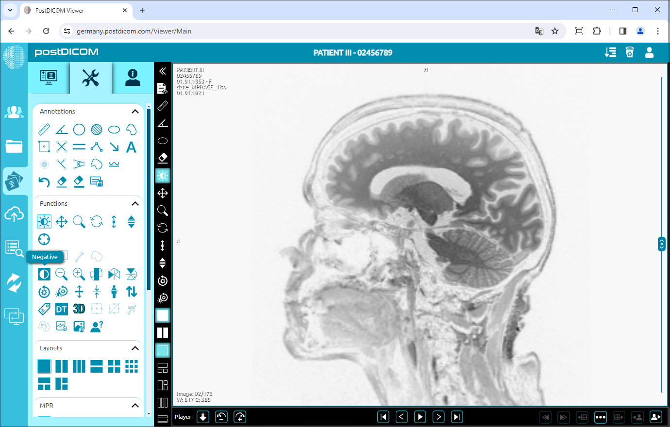 Using Negate, Rotate, Flip Vertical/Horizontal, Increase/Decrease Thickness, Zoom In/Out, Reset Functions