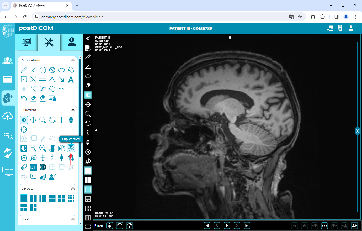 Using Negate, Rotate, Flip Vertical/Horizontal, Increase/Decrease Thickness, Zoom In/Out, Reset Functions