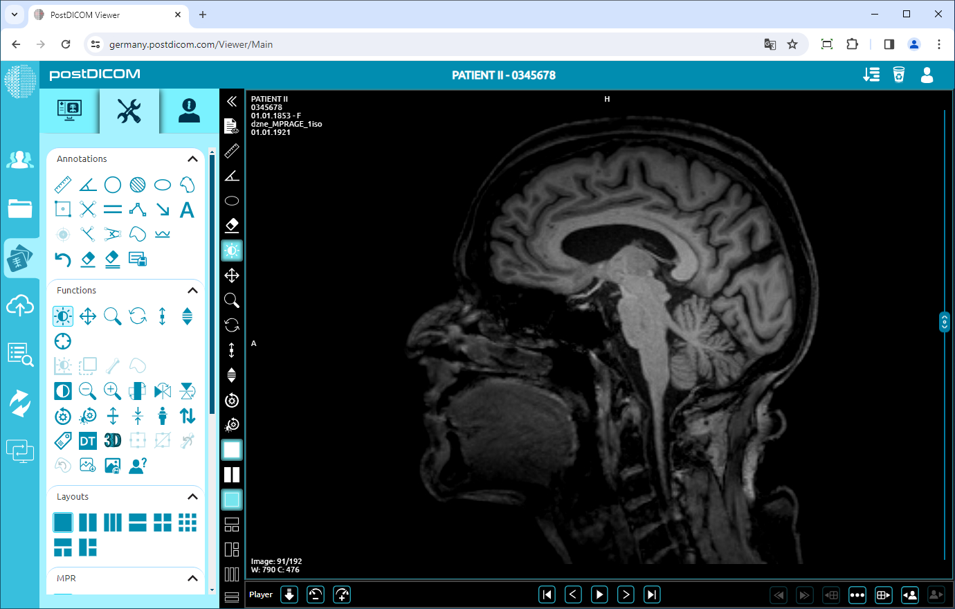 Using Window Level, Pan, Zoom, Rotation, Thickness and Scroll Functions